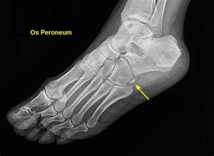 Os ‘Irmãos à Obra’ têm um irmão mais velho que anda chamando atenção